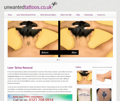 Laser Tattoo Removal Clinic Tattoo Removal In United Kingdom