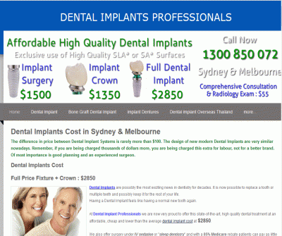 Dental Implants vs. Traditional Dentures: Which Is Better for Multiple Missing Teeth?