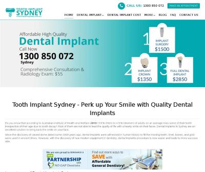 Importance of Getting a Dental Implant