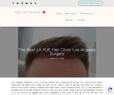 The Best LA FUE Hair Clinic Los Angeles Surgery