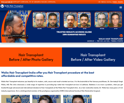 Hair Transplant Ludhiana