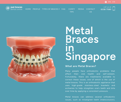 Metal Braces