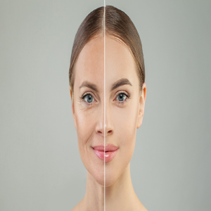 Distill Laser Clinic-https://www.distilllaserclinic.com/distill-laser-clinic-north-york/