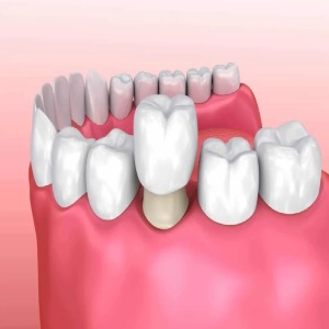 Soothing Care Dental Sydney, Australia General Dentistry Cosmetic Dentistry Dental Implants-https://www.scdental.com.au